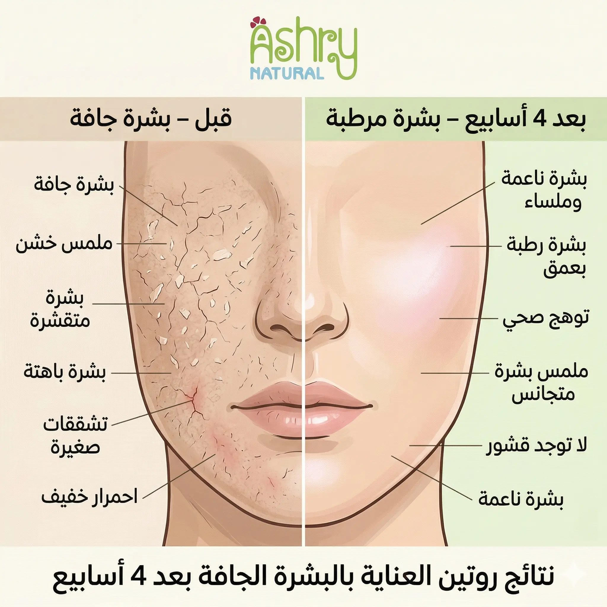 صورة قبل وبعد ترطيب البشرة الجافة وتحسن ملمس البشرة