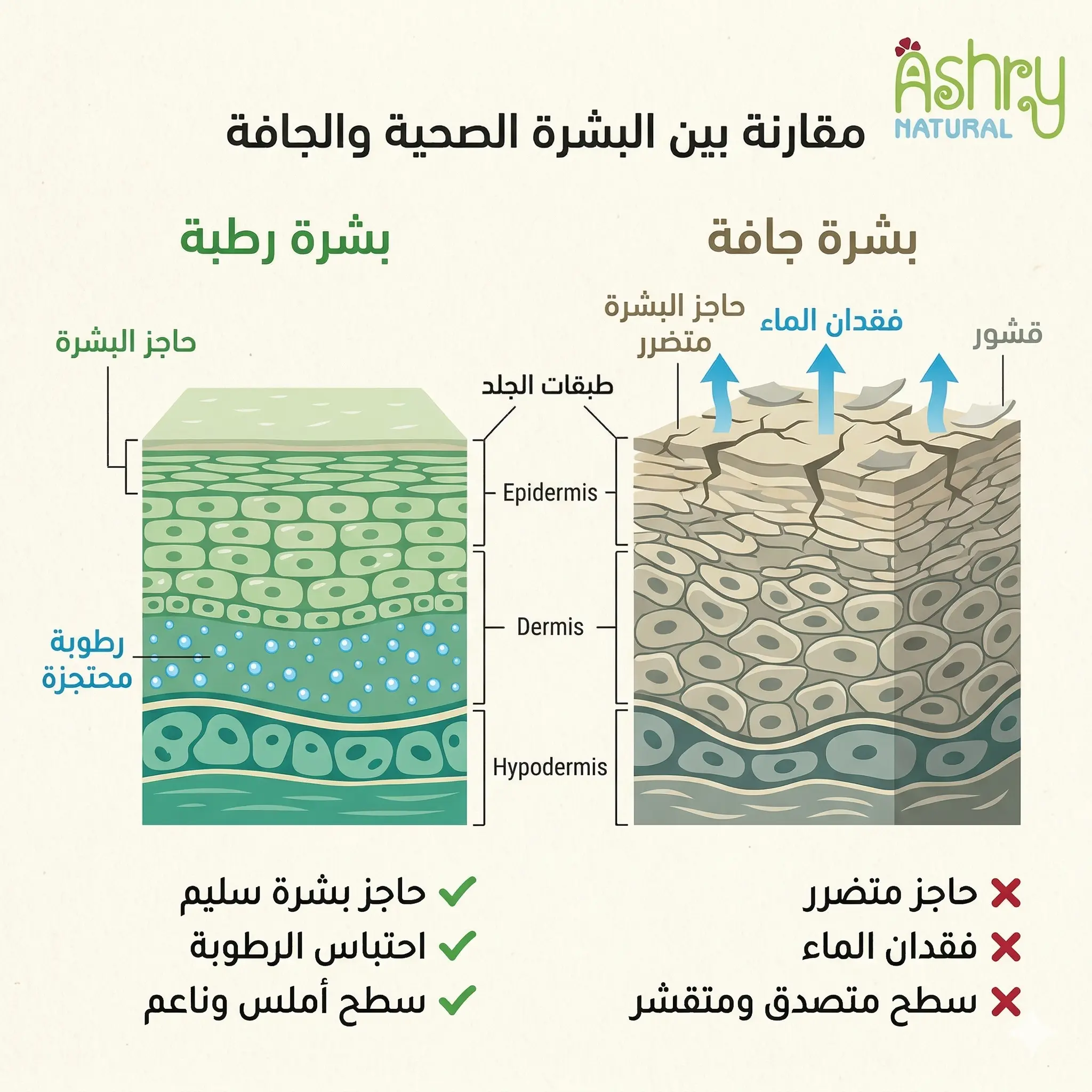 صورة توضح الفرق بين البشرة الجافة والبشرة السليمة وطبقات الجلد وحاجز البشرة